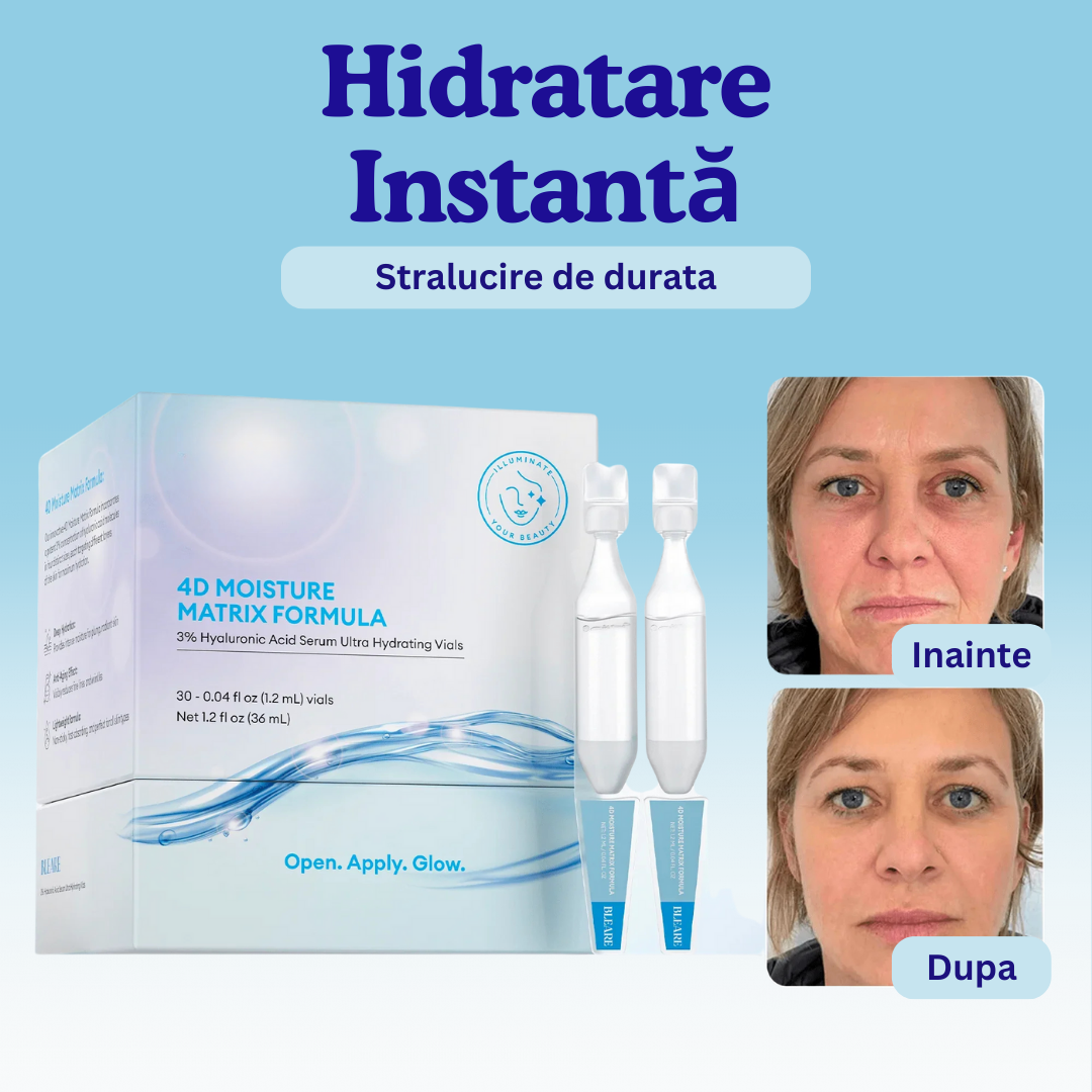 Ultra-Hydra 3% Acid Hialuronic Ser