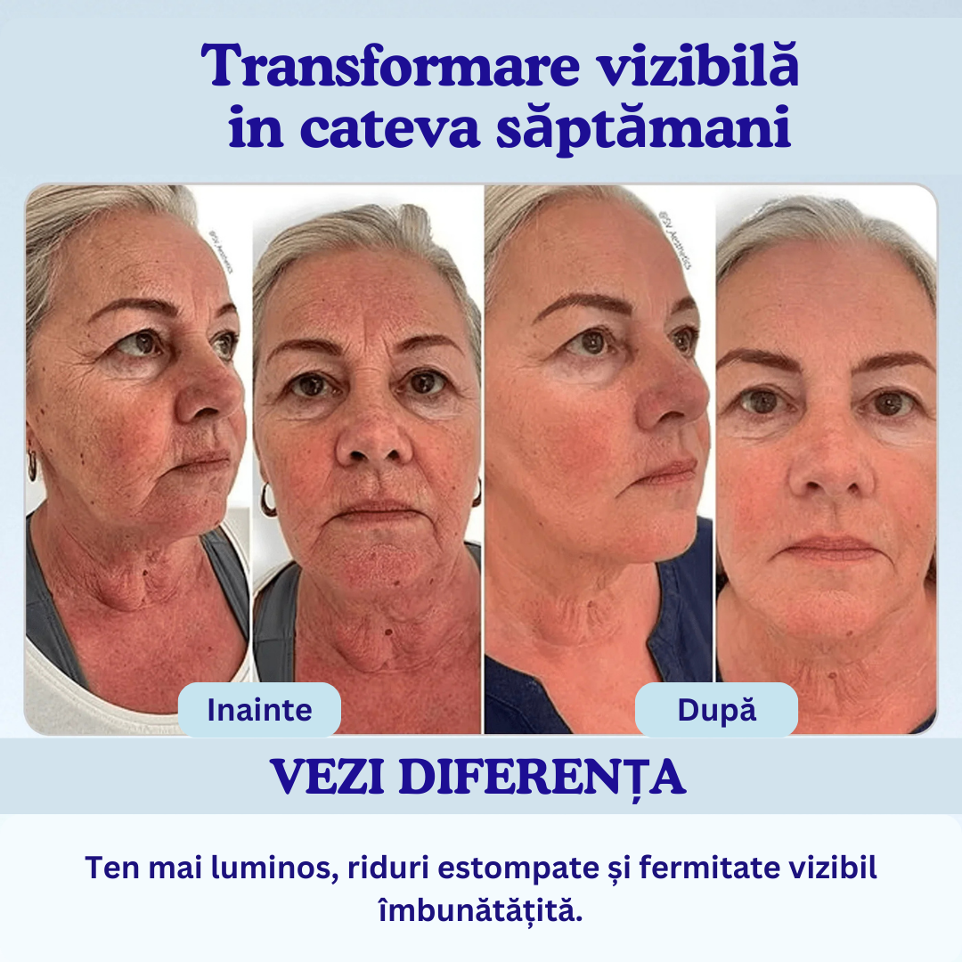 Ultra-Hydra 3% Acid Hialuronic Ser