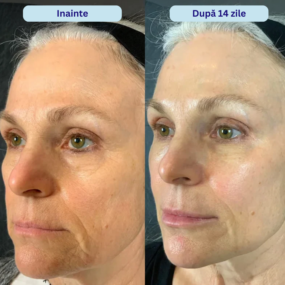 Ultra-Hydra 3% Acid Hialuronic Ser