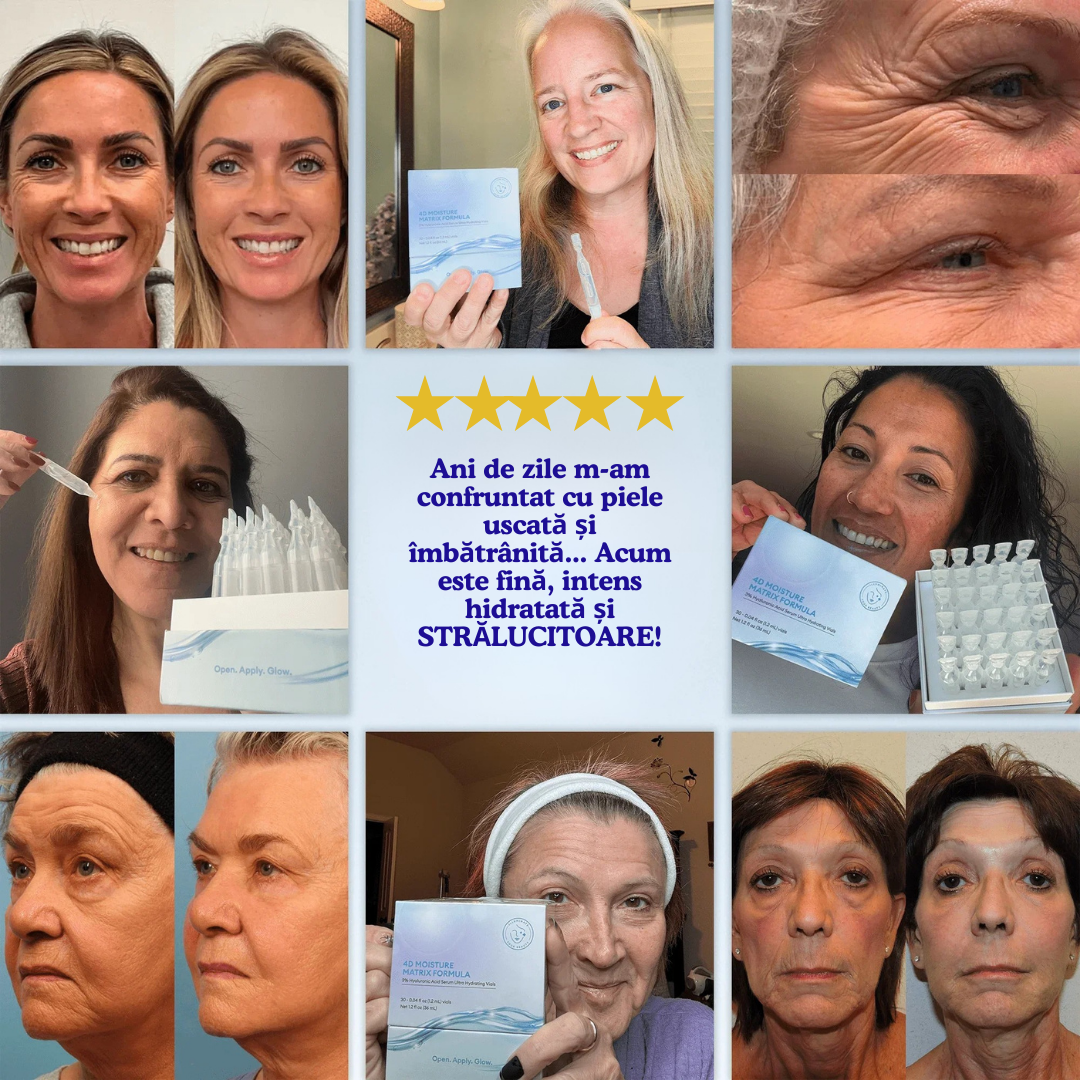 Ultra-Hydra 3% Acid Hialuronic Ser